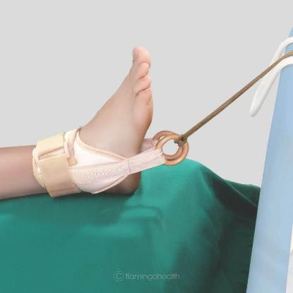 Picture of Flamingo Ankle Traction Brace - Universal